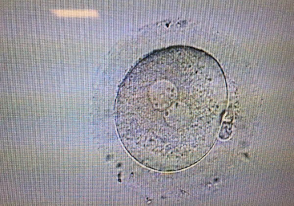 这才是0pn胚胎养囊成功的原因，看完就明白能不能移植了